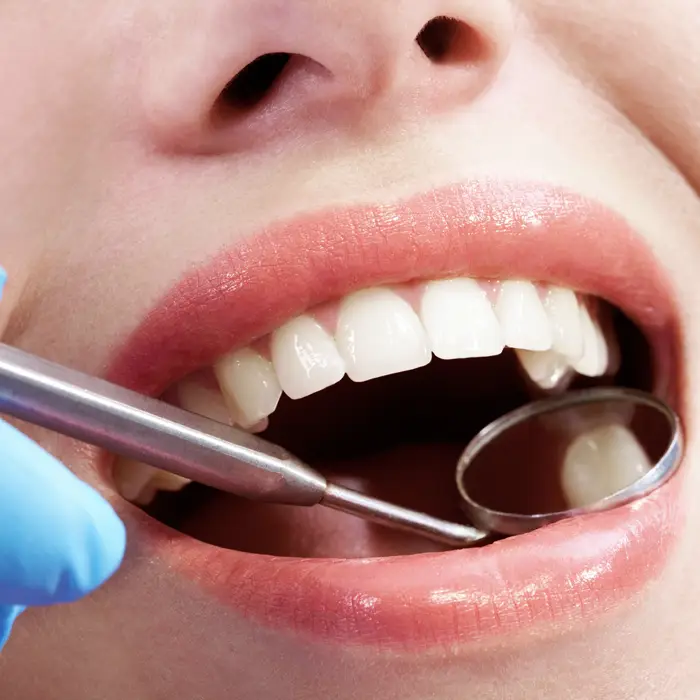 A dentist using a mirror on a woman in the chair